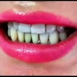 Alternative view of Begroting 🔔 Fenom Royal Tanden Bleken Strips - 14 Stuks - Bamboe - Houtskool - Mondzorg - Zonder Peroxide - Hygiëne 🛒