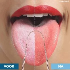 Alternative view of Goedkoopste 🧨 RX Goods Rosé Gouden Tongschraper Voor Mondverzorging – 4 Stuks – Duurzaam & Herbruikbaar 😍