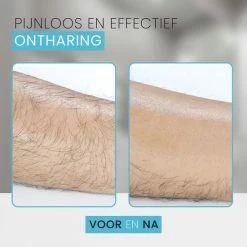 Flash-uitverkoop 🤩 Swinx Crystal Hair Removal Blauw – Scrubi Ontharing – Bleame – Hair Eraser – Kristalpad – Ontharingspad – Haarverwijderaar – Pijnloos Ontharen 🔔 9 Flash-uitverkoop 🤩 Swinx Crystal Hair Removal Blauw – Scrubi Ontharing – Bleame – Hair Eraser – Kristalpad – Ontharingspad – Haarverwijderaar – Pijnloos Ontharen 🔔 -BRAUN Shop 550x550 4